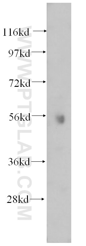 WB analysis of human brain using 14780-1-AP