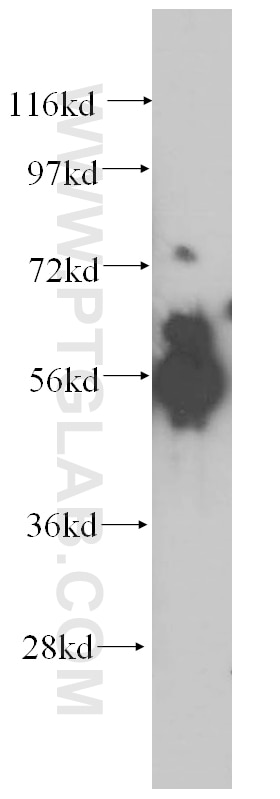 Western Blot (WB) analysis of human kidney tissue using ATP6V1B1 Polyclonal antibody (14780-1-AP)