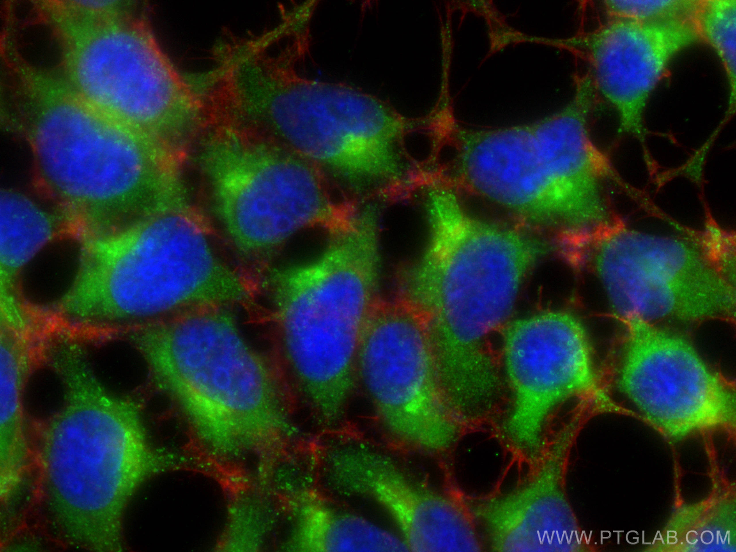 Immunofluorescence (IF) / fluorescent staining of HEK-293 cells using ATP6V1B1 Monoclonal antibody (68219-1-Ig)