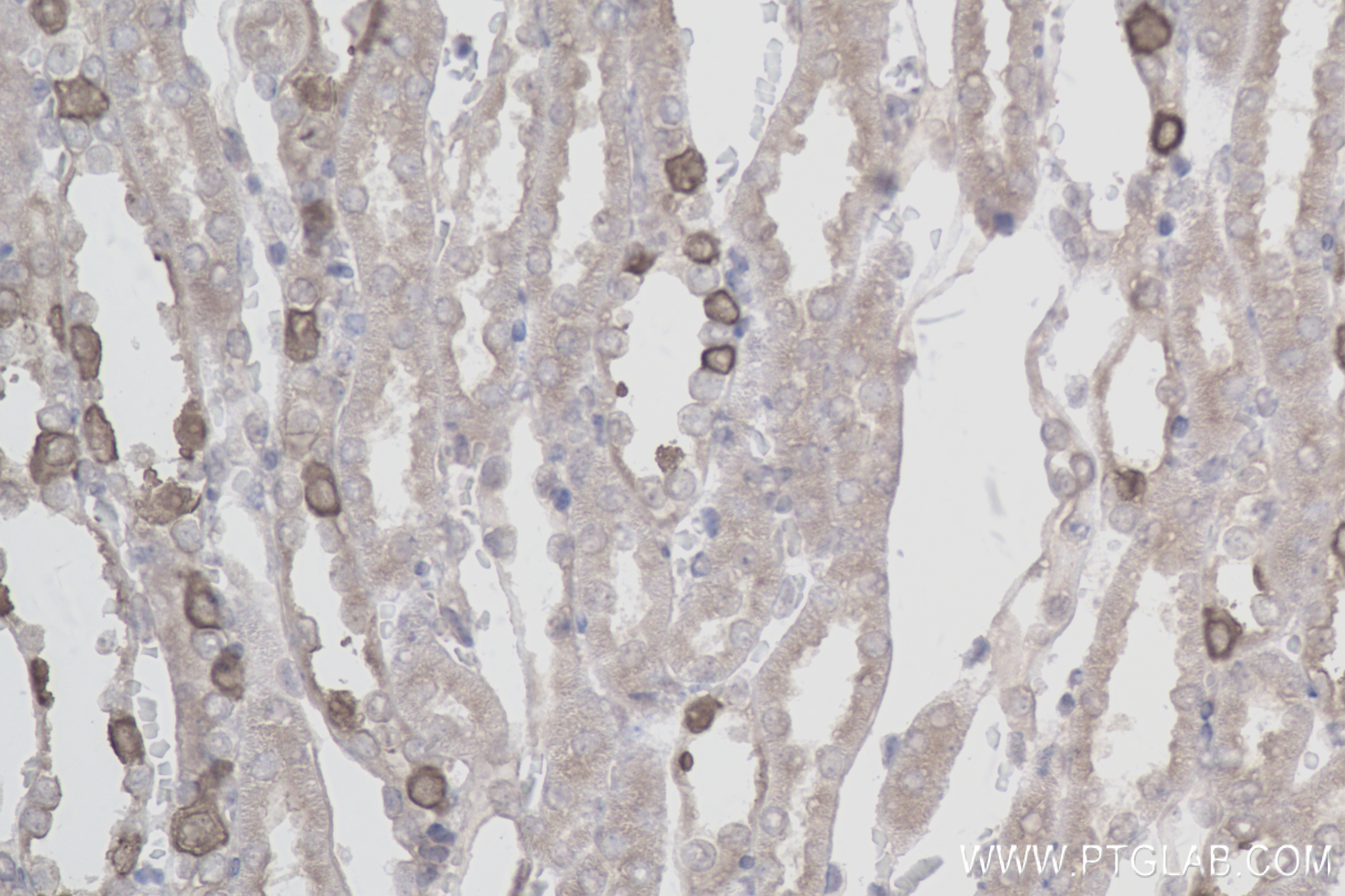 Immunohistochemistry (IHC) staining of mouse kidney tissue using ATP6V1B1 Recombinant antibody (83953-5-RR)
