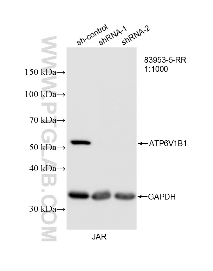WB analysis of JAR using 83953-5-RR Western Blot (WB) analysis of JAR cells using ATP6V1B1 Recombinant monoclonal antibody (83953-5-RR)