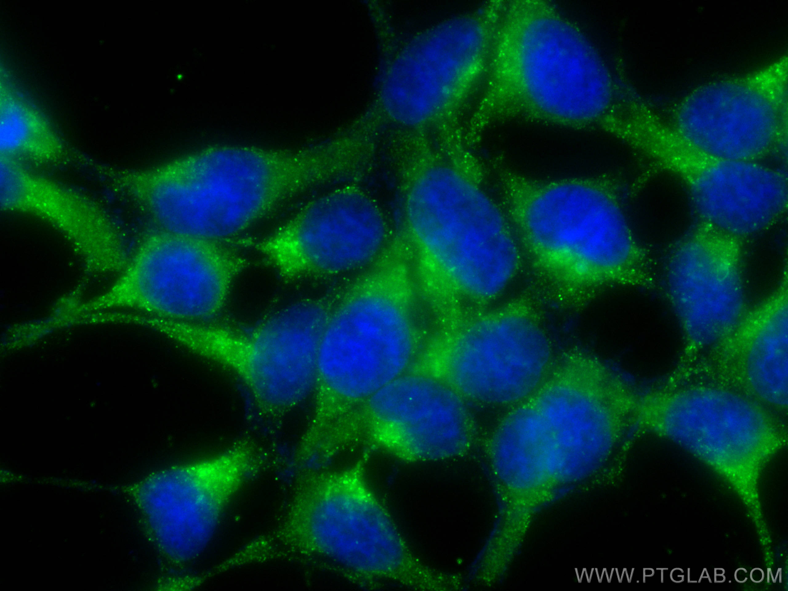 Immunofluorescence (IF) / fluorescent staining of HEK-293 cells using CoraLite® Plus 488-conjugated ATP6V1B1 Monoclonal  (CL488-68219)