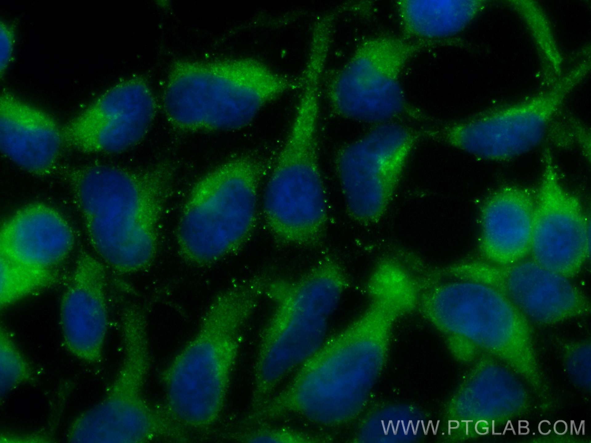 Immunofluorescence (IF) / fluorescent staining of HEK-293 cells using CoraLite® Plus 488-conjugated ATP6V1B1 Monoclonal  (CL488-68219)