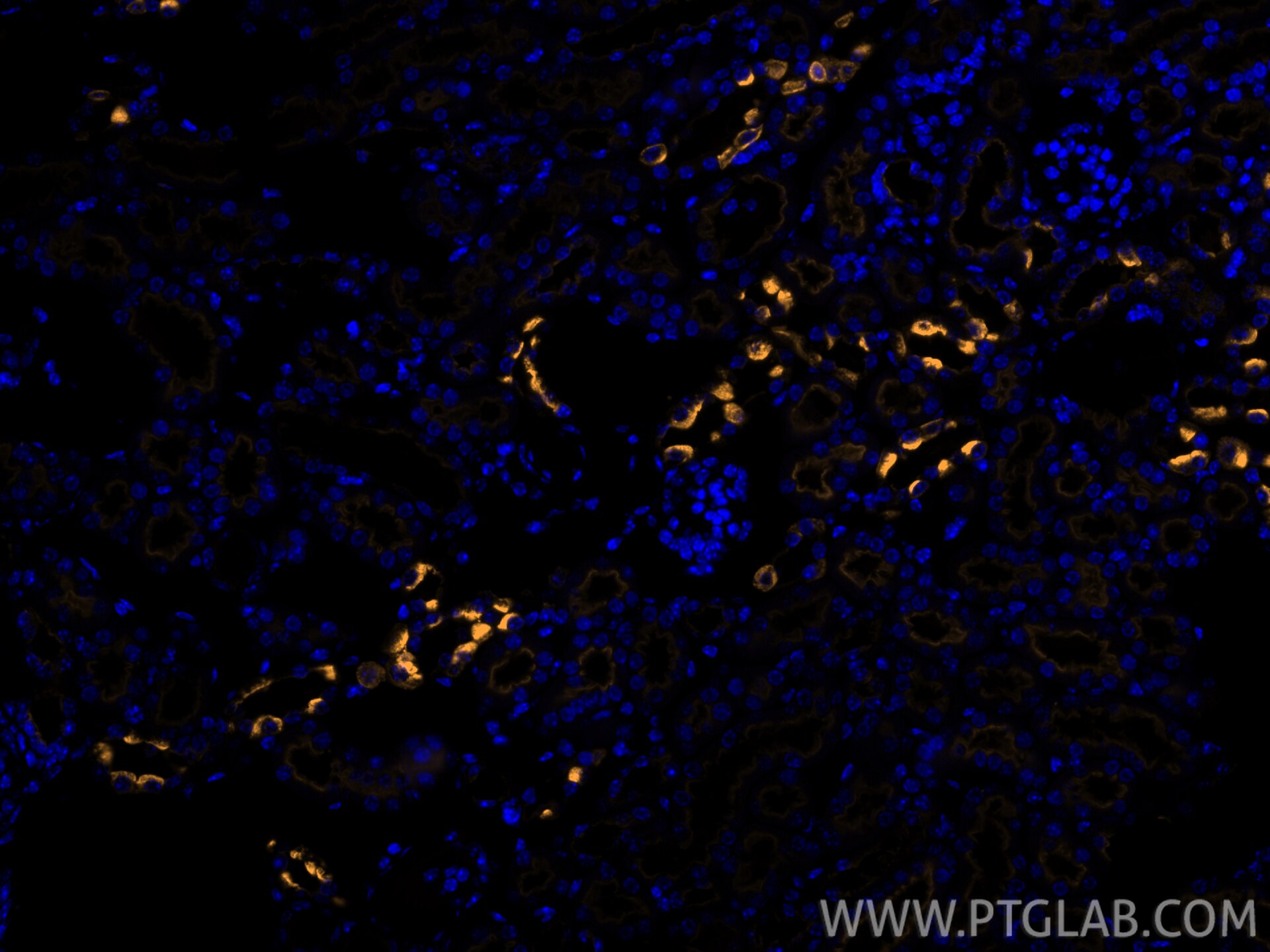 IF Staining of mouse kidney using CL555-83953-5 Immunofluorescence (IF) / fluorescent staining of mouse kidney tissue using CoraLite® Plus 555-conjugated ATP6V1B1 Recombinant (CL555-83953-5)