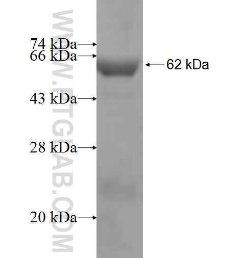 ATP6V1B1 fusion protein Ag6332 SDS-PAGE