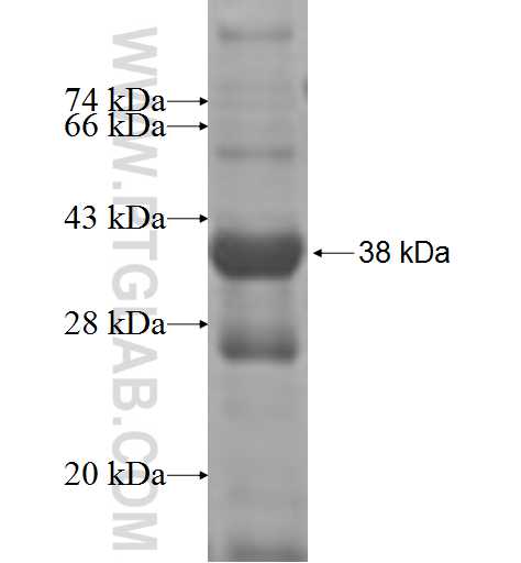 ATP6V1B1 fusion protein Ag7405 SDS-PAGE