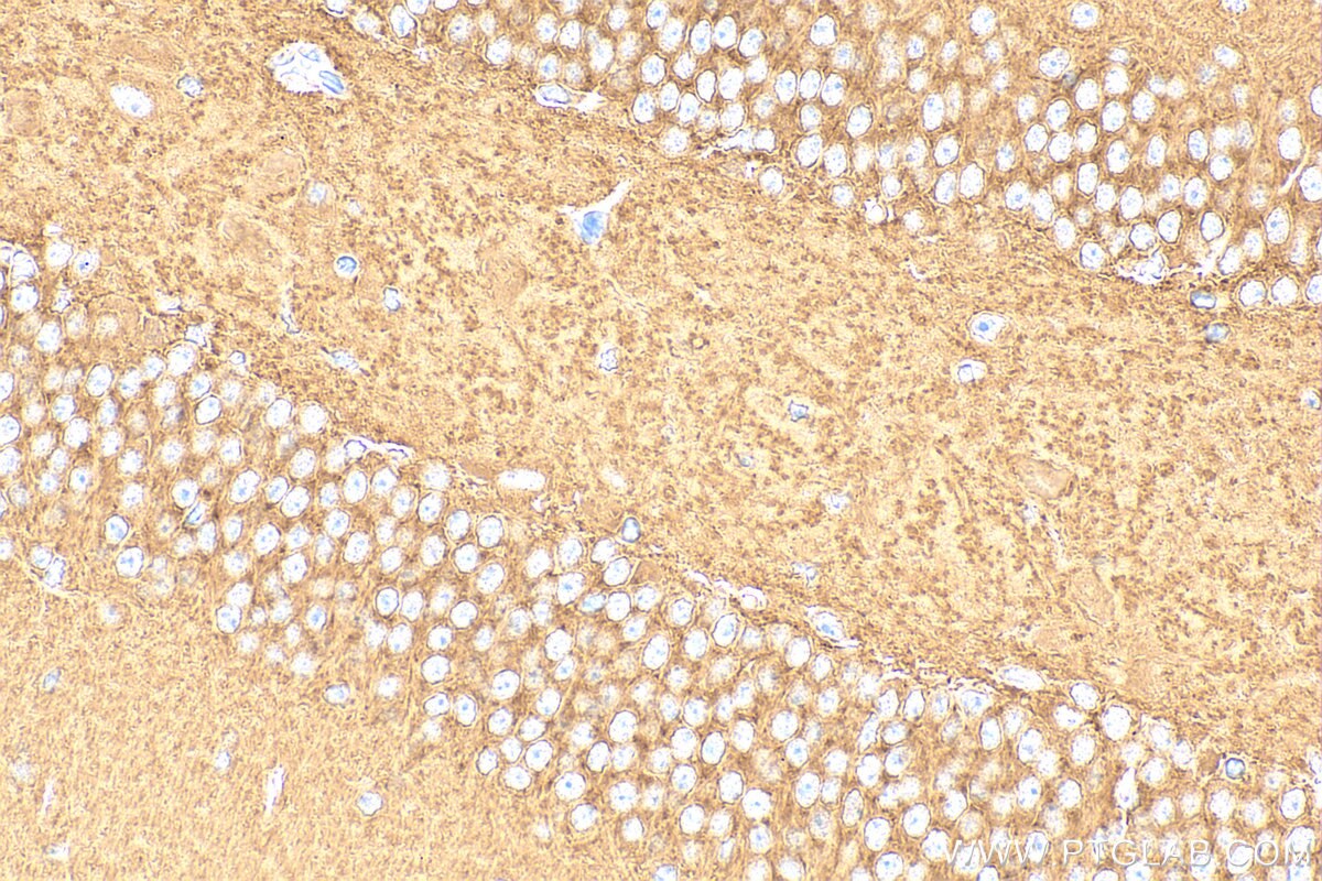Immunohistochemistry (IHC) staining of mouse brain tissue using ATP6V1B2 Polyclonal antibody (15097-1-AP)