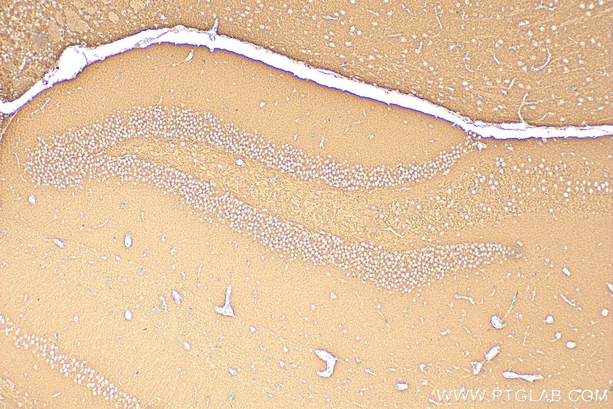 Immunohistochemistry (IHC) staining of mouse brain tissue using ATP6V1B2 Polyclonal antibody (15097-1-AP)
