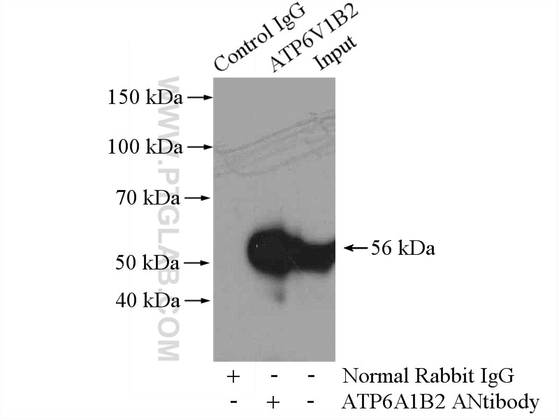 Immunoprecipitation (IP) experiment of mouse brain tissue using ATP6V1B2 Polyclonal antibody (15097-1-AP)