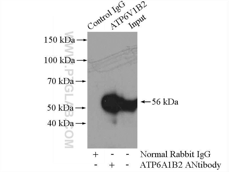 IP experiment of mouse brain using 15097-1-AP