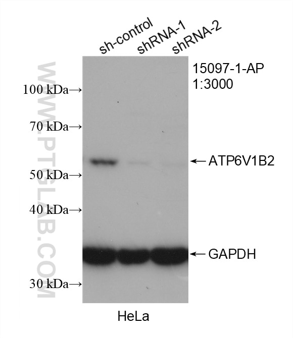 Western Blot (WB) analysis of HeLa cells using ATP6V1B2 Polyclonal antibody (15097-1-AP)