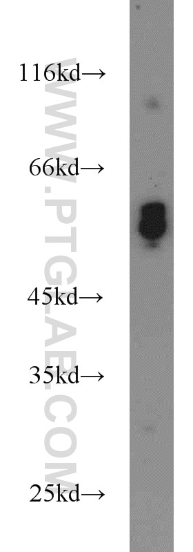 Western Blot (WB) analysis of mouse skeletal muscle tissue using ATP6V1B2 Polyclonal antibody (15097-1-AP)