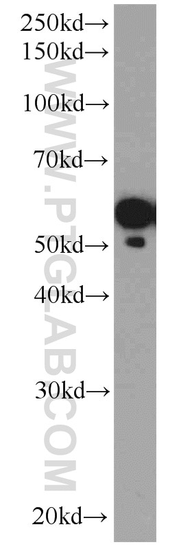 Western Blot (WB) analysis of mouse heart tissue using ATP6V1B2 Polyclonal antibody (15097-1-AP)