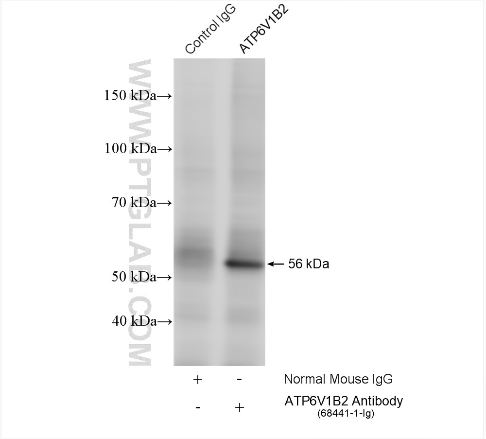Immunoprecipitation (IP) experiment of HeLa cells using ATP6V1B2 Monoclonal antibody (68441-1-Ig)