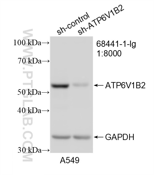 Western Blot (WB) analysis of A549 cells using ATP6V1B2 Monoclonal antibody (68441-1-Ig)