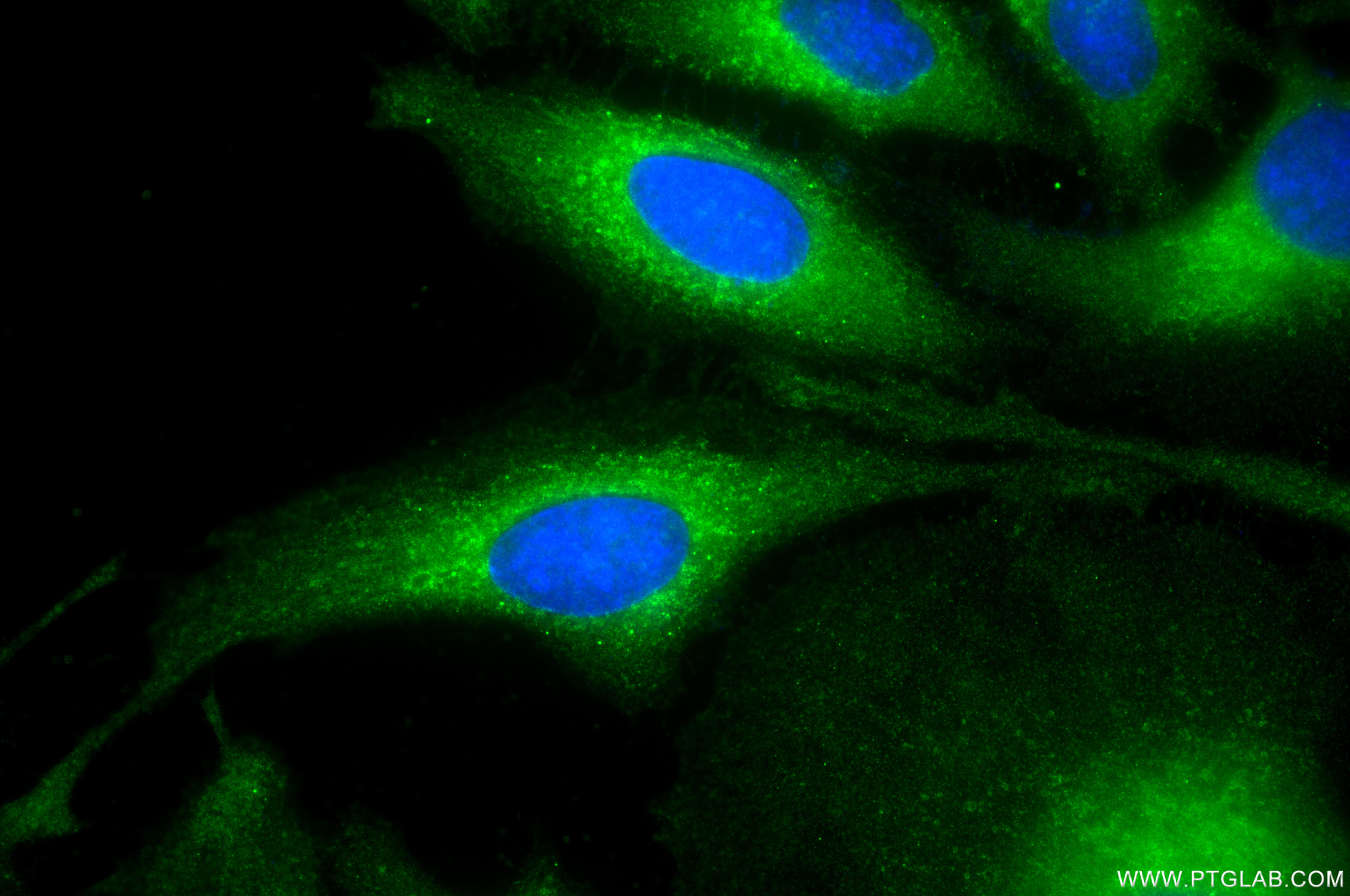 Immunofluorescence (IF) / fluorescent staining of HeLa cells using ATP6V1B2 Recombinant monoclonal antibody (87302-4-RR)