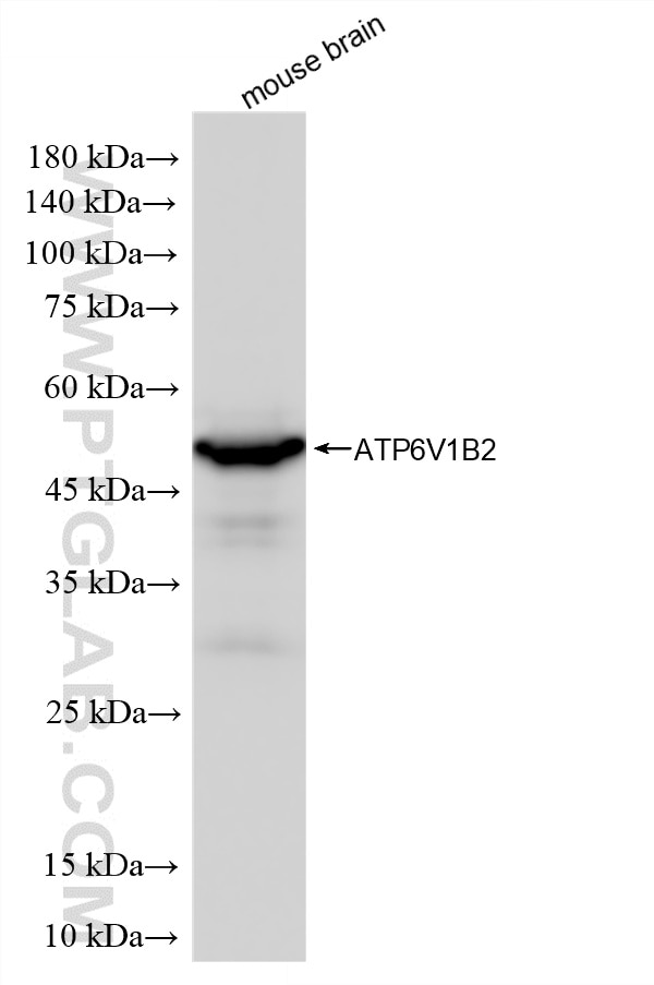 Western Blot (WB) analysis of mouse brain tissue using ATP6V1B2 Recombinant monoclonal antibody (87302-4-RR)