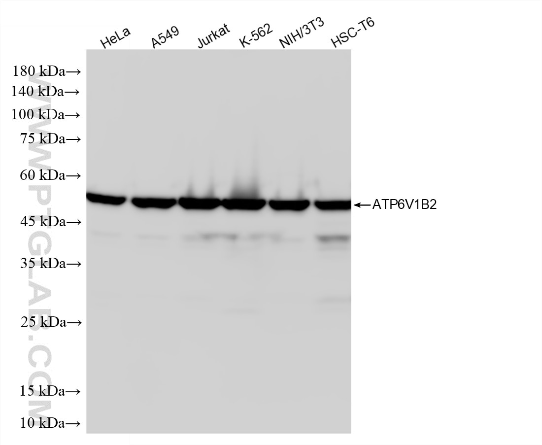 Western Blot (WB) analysis of various lysates using ATP6V1B2 Recombinant monoclonal antibody (87302-4-RR)
