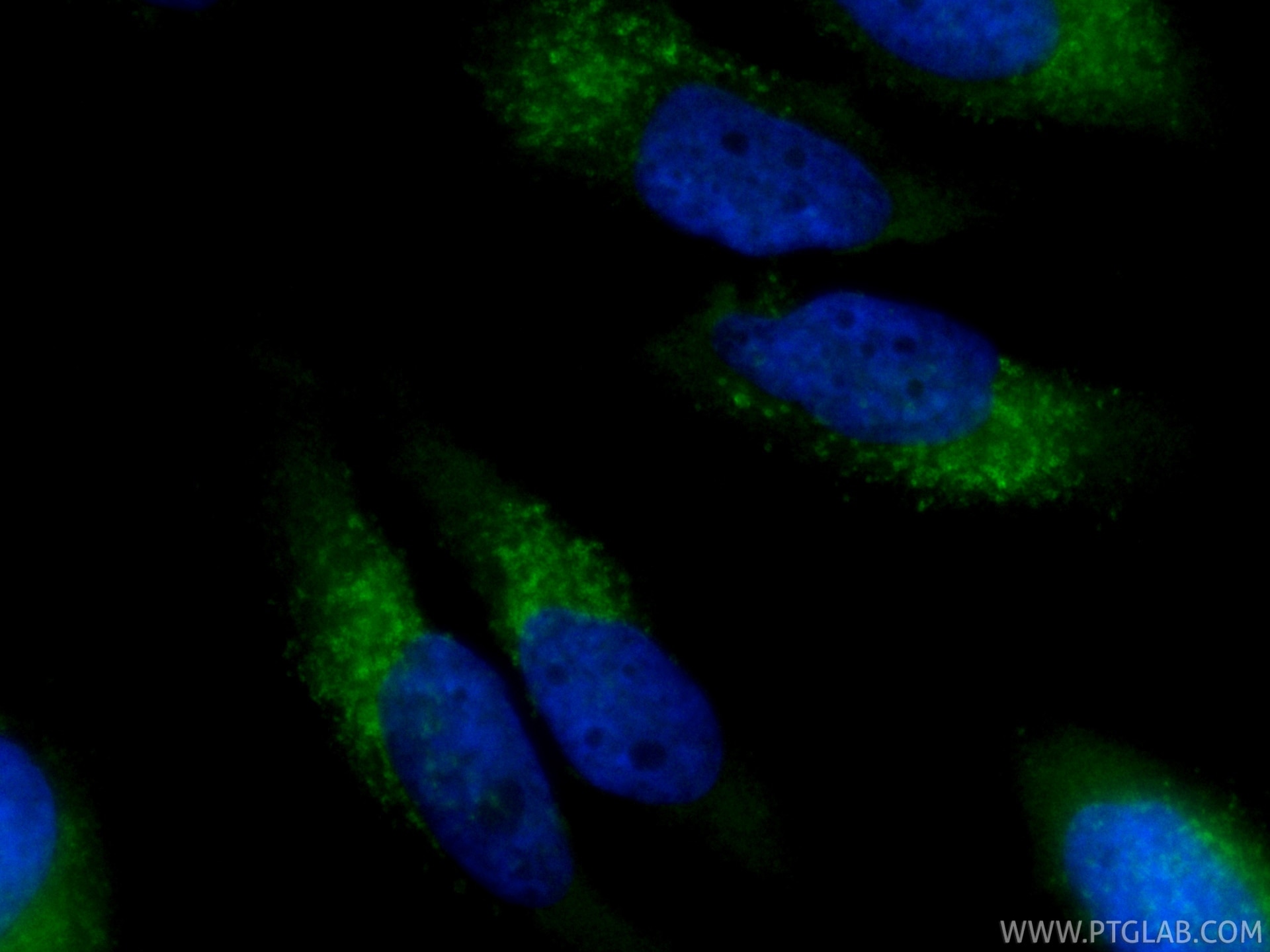 IF Staining of HeLa using CL488-87302-4 Immunofluorescence (IF) / fluorescent staining of HeLa cells using CoraLite® Plus 488-conjugated ATP6V1B2 Recombinant (CL488-87302-4)