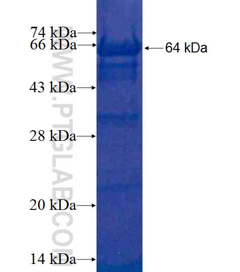 ATP6V1B2 fusion protein Ag7174 SDS-PAGE
