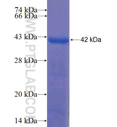 ATP6V1B2 fusion protein Ag7265 SDS-PAGE