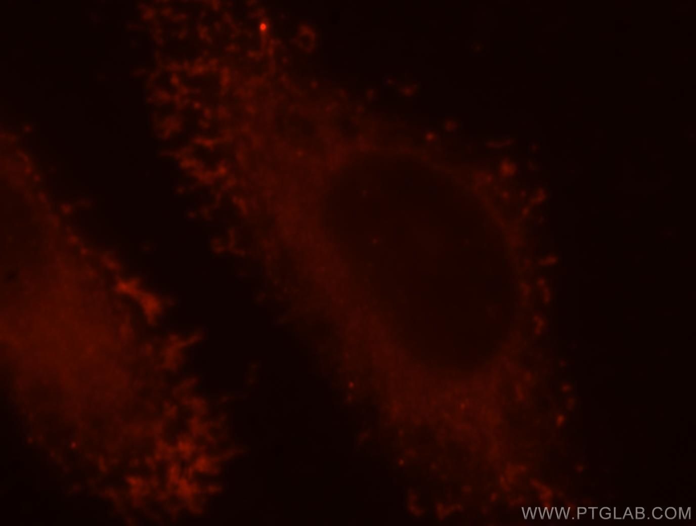 ATP6V1C1