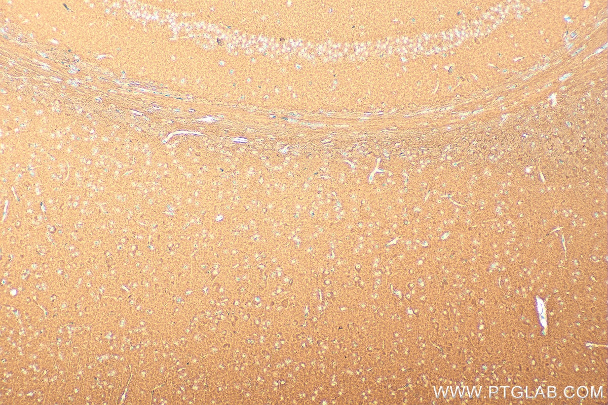 Immunohistochemistry (IHC) staining of mouse brain tissue using ATP6V1C1 Polyclonal antibody (16054-1-AP)