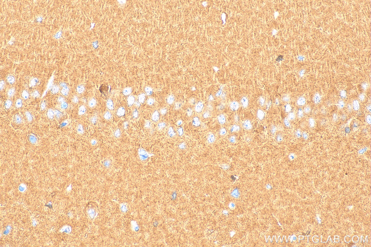 Immunohistochemistry (IHC) staining of mouse brain tissue using ATP6V1C1 Polyclonal antibody (16054-1-AP)