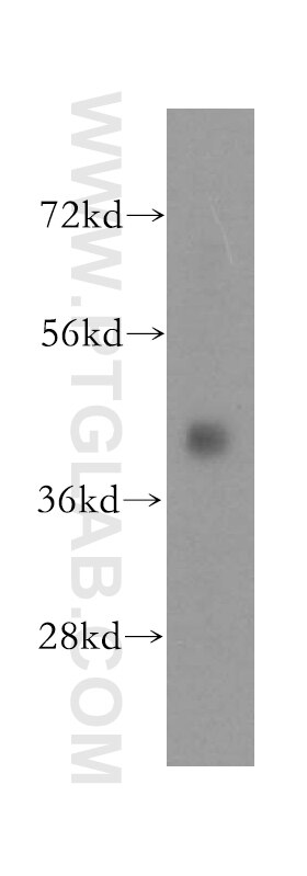 Western Blot (WB) analysis of human brain tissue using ATP6V1C1 Polyclonal antibody (16054-1-AP)