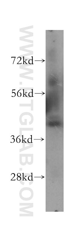Western Blot (WB) analysis of human testis tissue using ATP6V1C1 Polyclonal antibody (16054-1-AP)