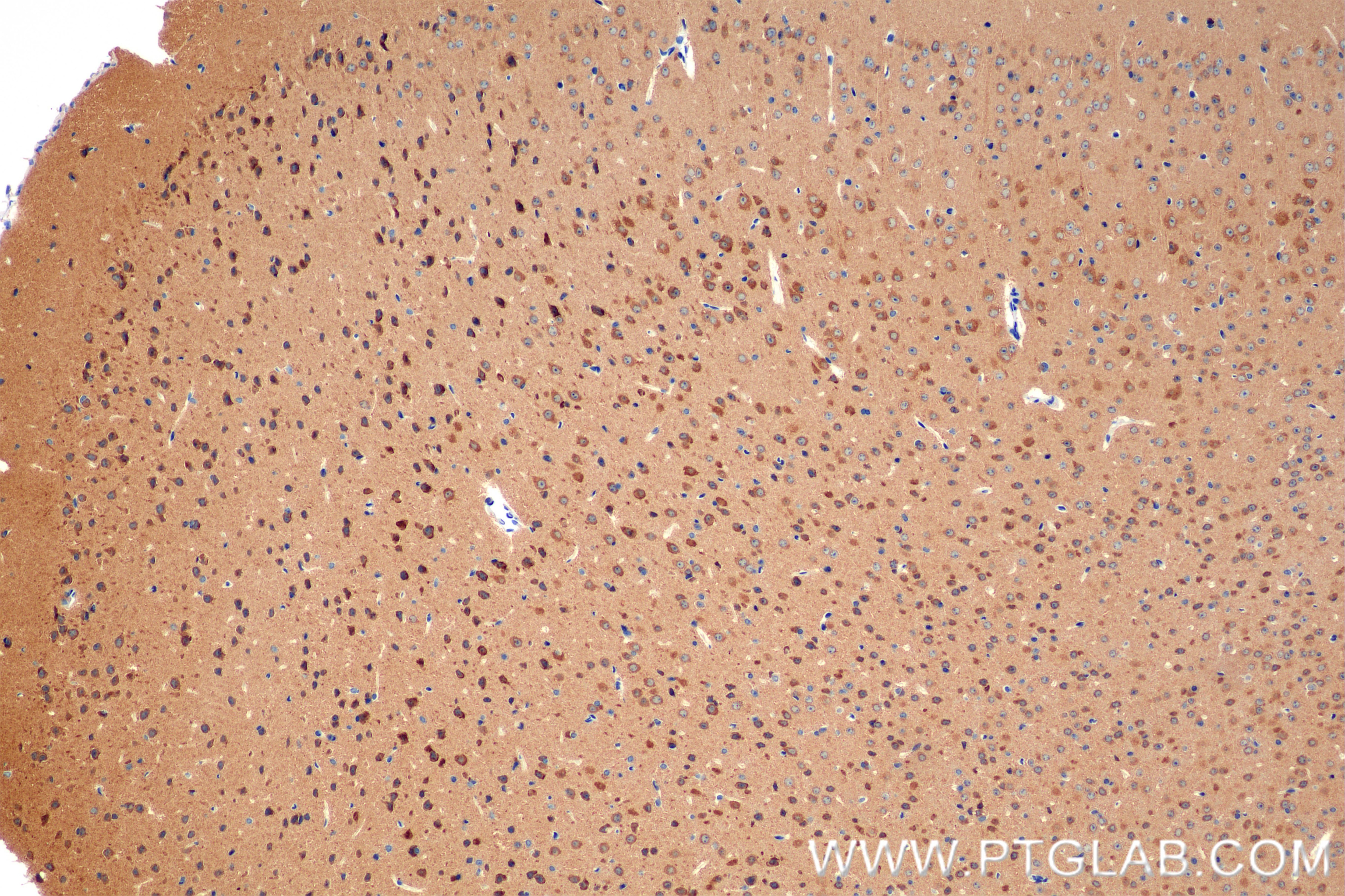 Immunohistochemistry (IHC) staining of mouse brain tissue using ATP6V1C1 Recombinant antibody (86345-2-RR)