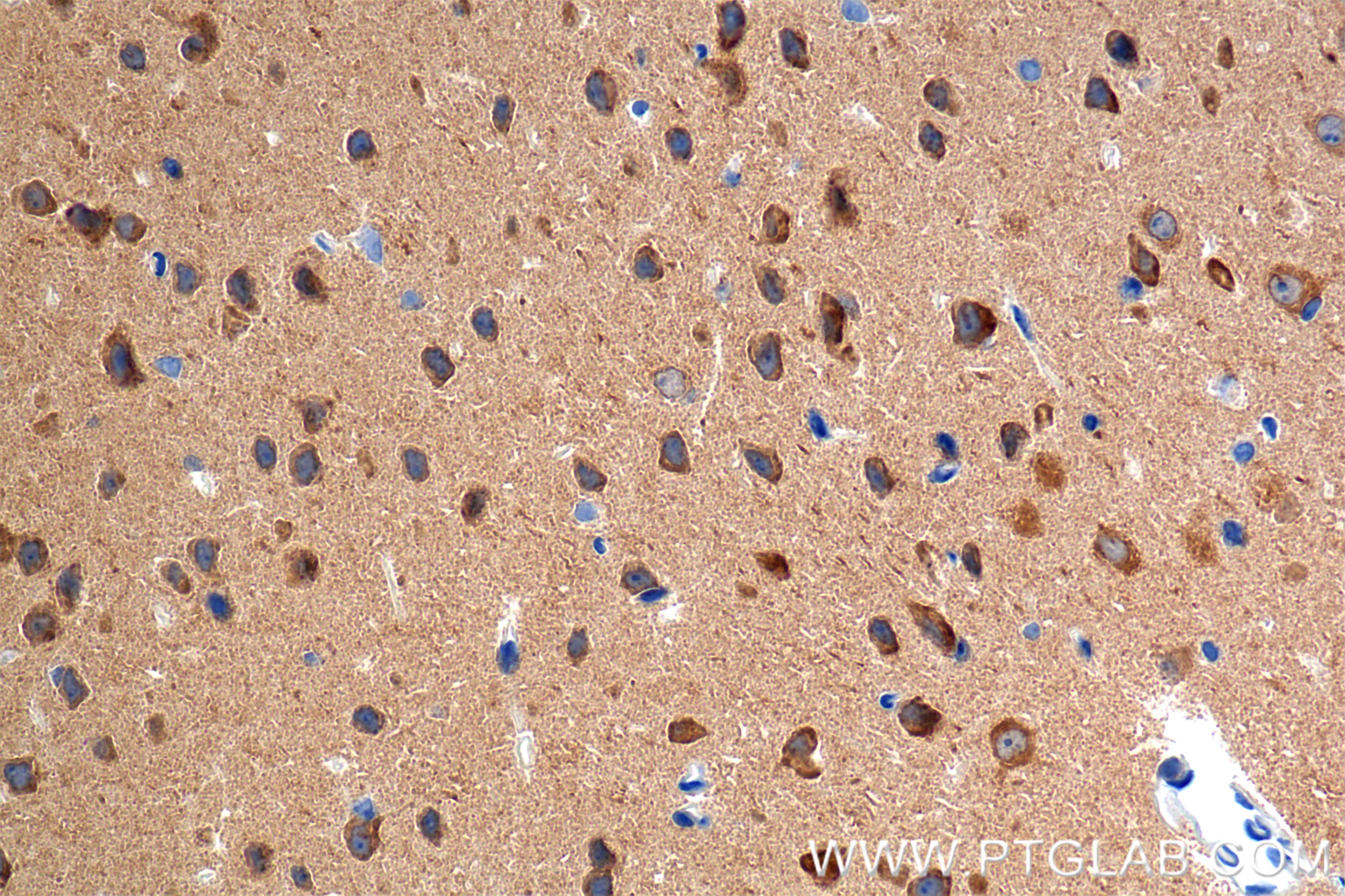 Immunohistochemistry (IHC) staining of mouse brain tissue using ATP6V1C1 Recombinant antibody (86345-2-RR)