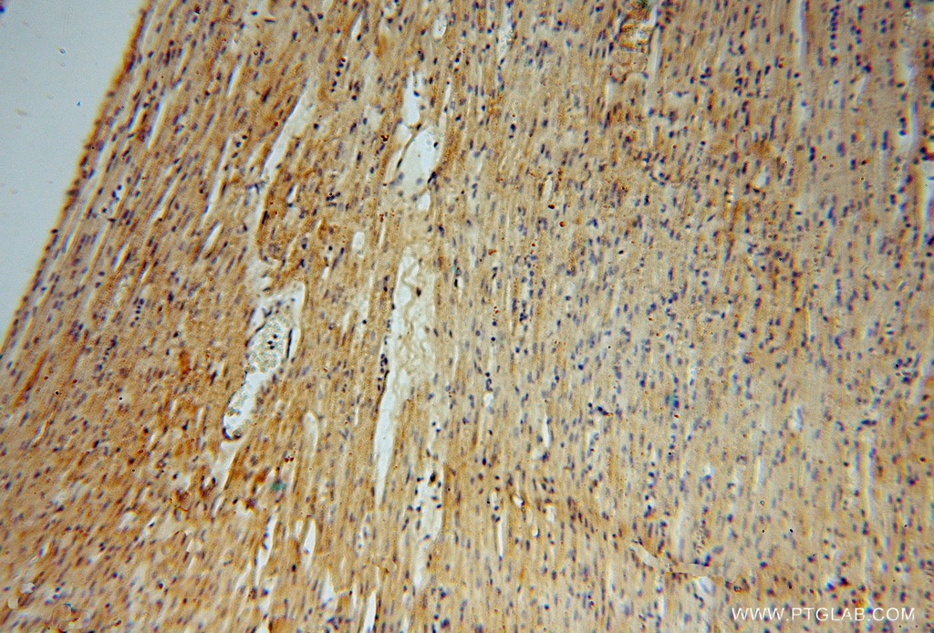 Immunohistochemistry (IHC) staining of human heart tissue using ATP6V1C2 Polyclonal antibody (16274-1-AP)