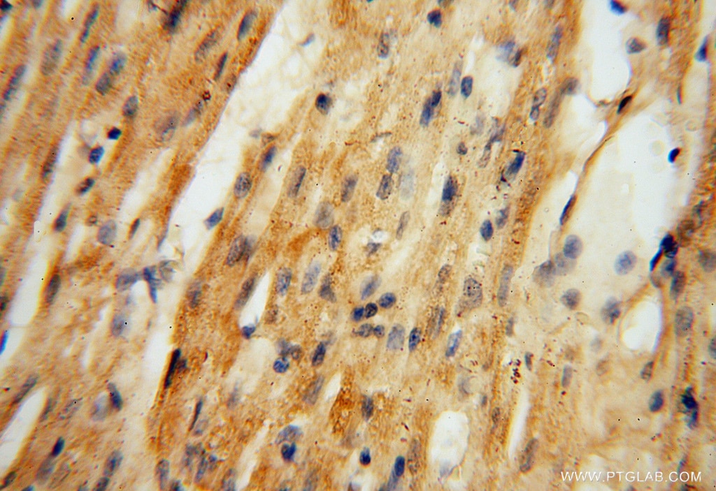 Immunohistochemistry (IHC) staining of human heart tissue using ATP6V1C2 Polyclonal antibody (16274-1-AP)