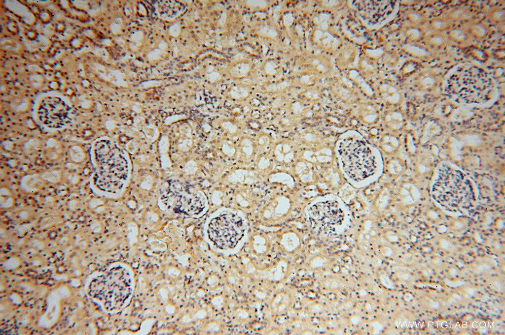 Immunohistochemistry (IHC) staining of human kidney tissue using ATP6V1C2 Polyclonal antibody (16274-1-AP)