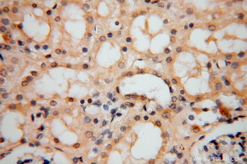 Immunohistochemistry (IHC) staining of human kidney tissue using ATP6V1C2 Polyclonal antibody (16274-1-AP)