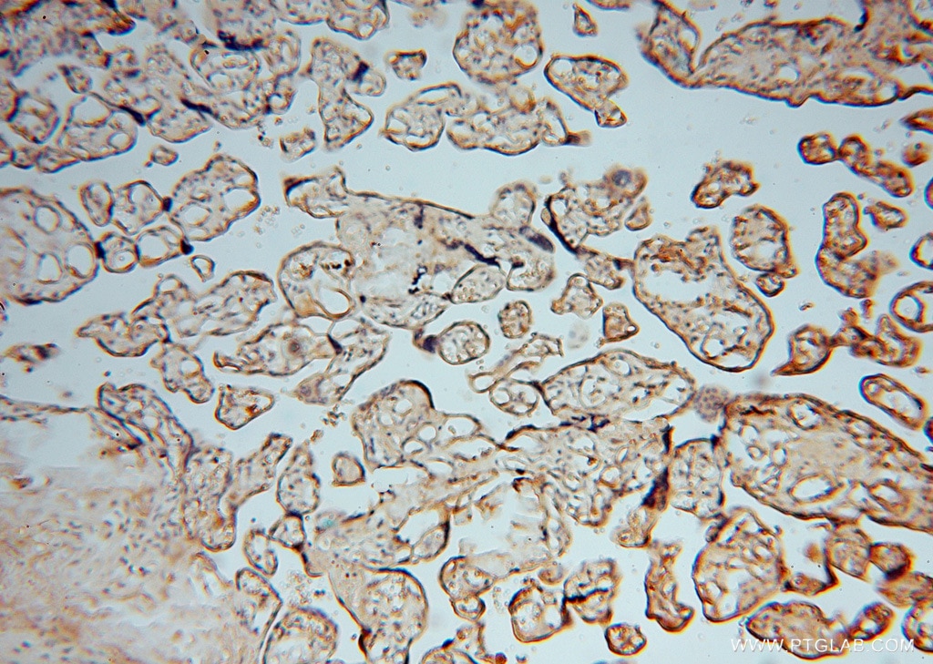 IHC staining of human placenta using 16274-1-AP