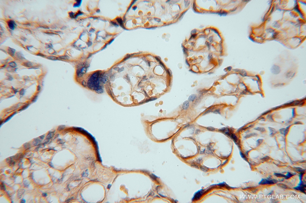 Immunohistochemistry (IHC) staining of human placenta tissue using ATP6V1C2 Polyclonal antibody (16274-1-AP)