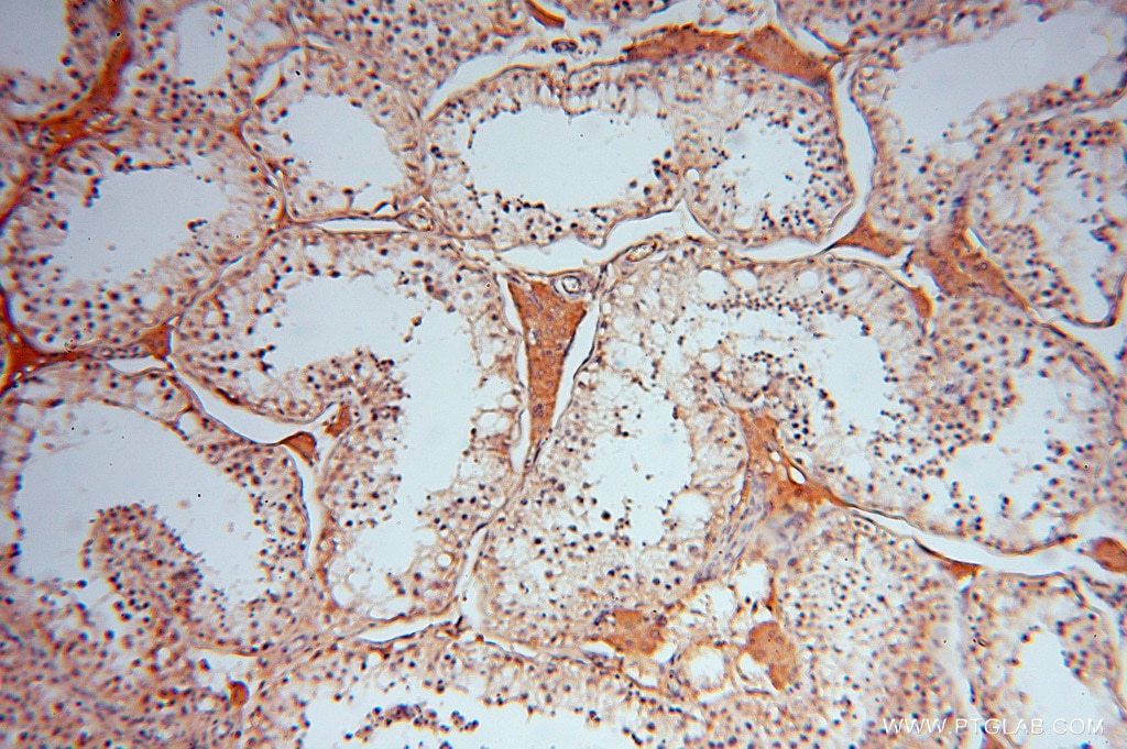 Immunohistochemistry (IHC) staining of human testis tissue using ATP6V1C2 Polyclonal antibody (16274-1-AP)