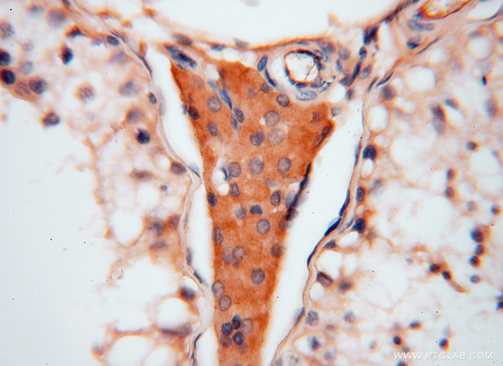 Immunohistochemistry (IHC) staining of human testis tissue using ATP6V1C2 Polyclonal antibody (16274-1-AP)