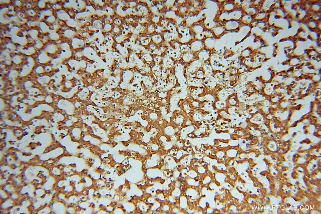 Immunohistochemistry (IHC) staining of human liver tissue using ATP6V1C2 Polyclonal antibody (16274-1-AP)