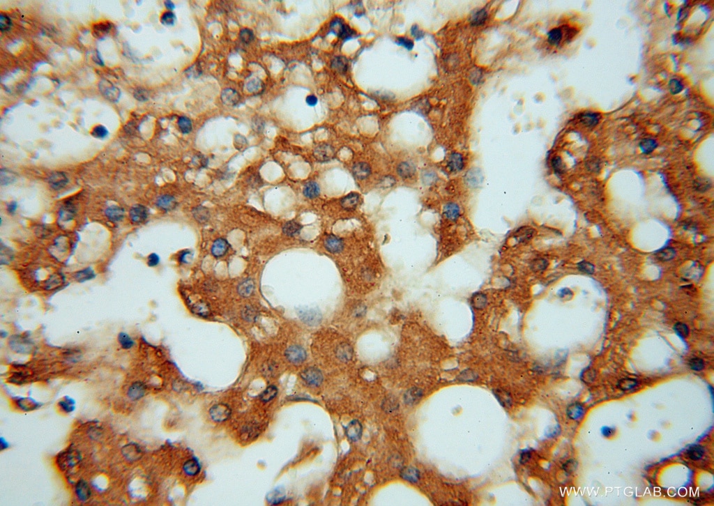 Immunohistochemistry (IHC) staining of human liver tissue using ATP6V1C2 Polyclonal antibody (16274-1-AP)