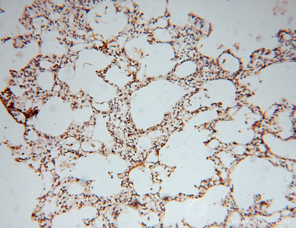 Immunohistochemistry (IHC) staining of human lung tissue using ATP6V1C2 Polyclonal antibody (16274-1-AP)
