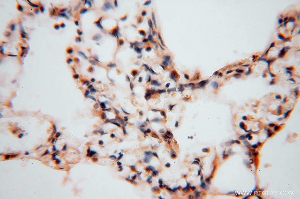 Immunohistochemistry (IHC) staining of human lung tissue using ATP6V1C2 Polyclonal antibody (16274-1-AP)