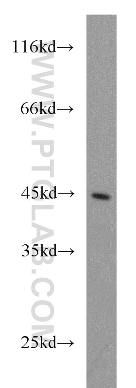 Western Blot (WB) analysis of human kidney tissue using ATP6V1C2 Polyclonal antibody (16274-1-AP)