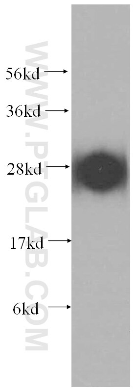 Western Blot (WB) analysis of human brain tissue using ATP6V1D Polyclonal antibody (14920-1-AP)