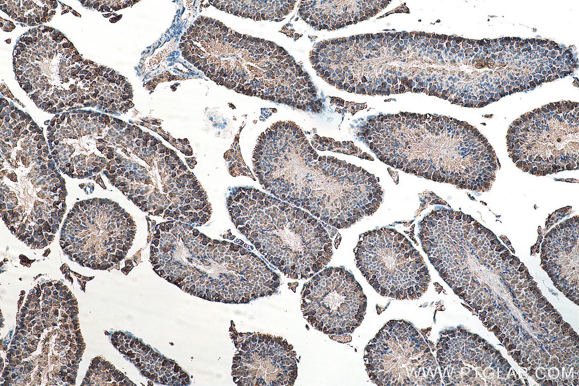 Immunohistochemistry (IHC) staining of mouse testis tissue using ATP6V1E1 Polyclonal antibody (15280-1-AP)
