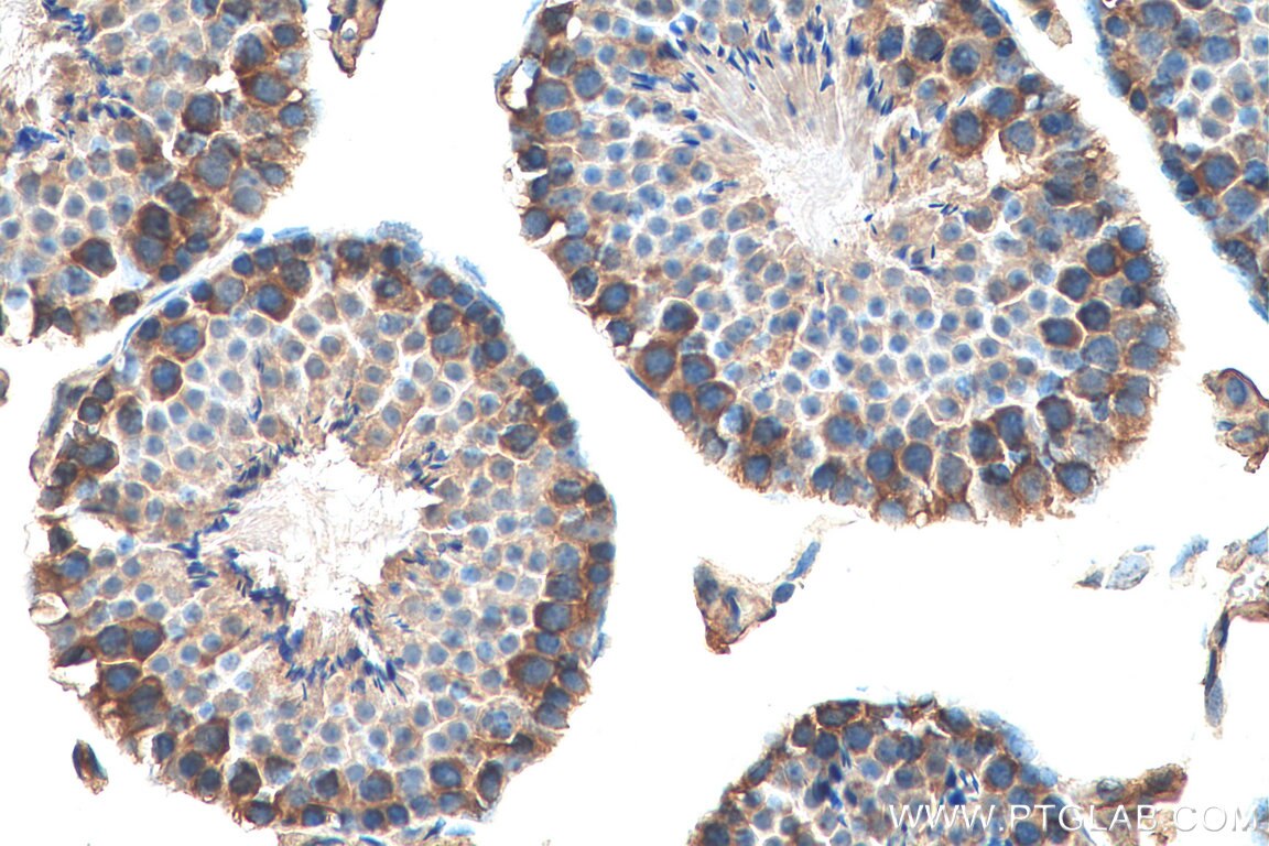 Immunohistochemistry (IHC) staining of mouse testis tissue using ATP6V1E1 Polyclonal antibody (15280-1-AP)