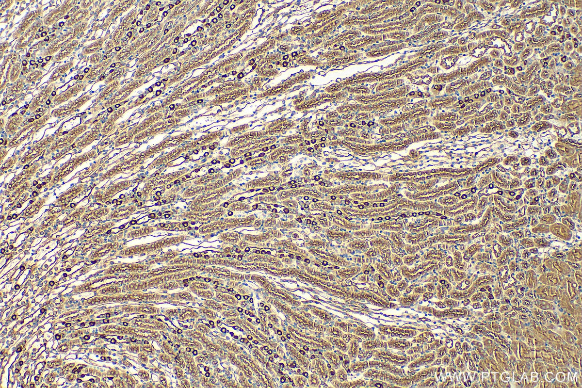 Immunohistochemistry (IHC) staining of mouse kidney tissue using ATP6V1E1 Polyclonal antibody (15280-1-AP)