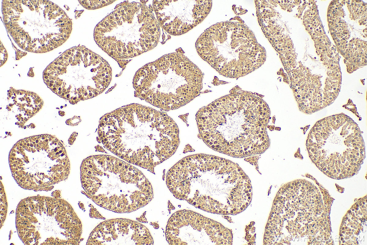 Immunohistochemistry (IHC) staining of mouse testis tissue using ATP6V1E1 Polyclonal antibody (15280-1-AP)